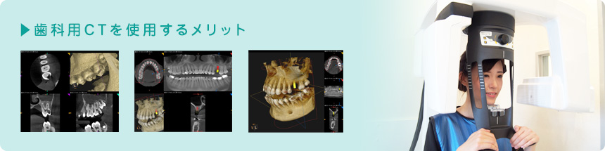 歯科用CTを使用するメリット